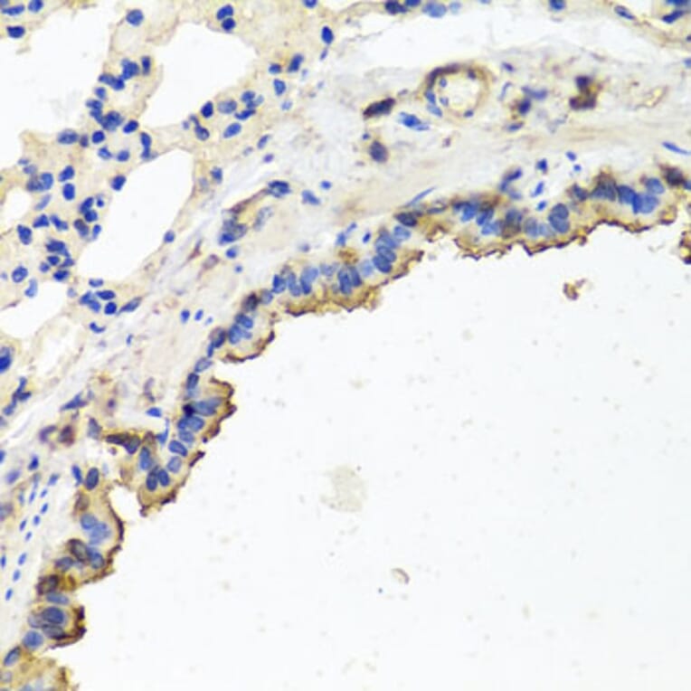 Immunohistochemistry - Anti-TUBB8 Antibody (A8396) - Antibodies.com