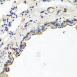 Immunohistochemistry - Anti-TUBB8 Antibody (A8396) - Antibodies.com
