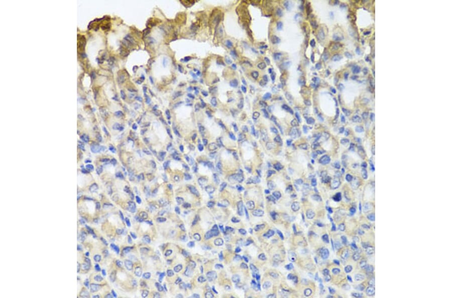 Immunohistochemistry - Anti-TUBB8 Antibody (A8396) - Antibodies.com