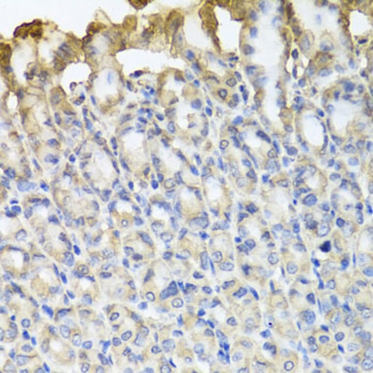 Immunohistochemistry - Anti-TUBB8 Antibody (A8396) - Antibodies.com