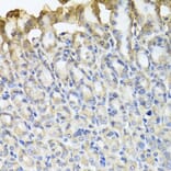 Immunohistochemistry - Anti-TUBB8 Antibody (A8396) - Antibodies.com