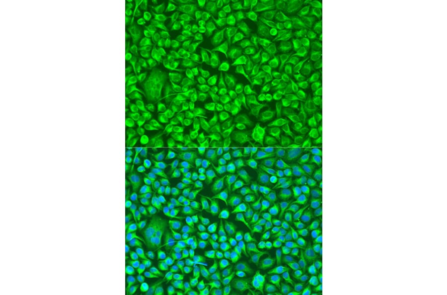Immunofluorescence - Anti-TUBB8 Antibody (A8396) - Antibodies.com