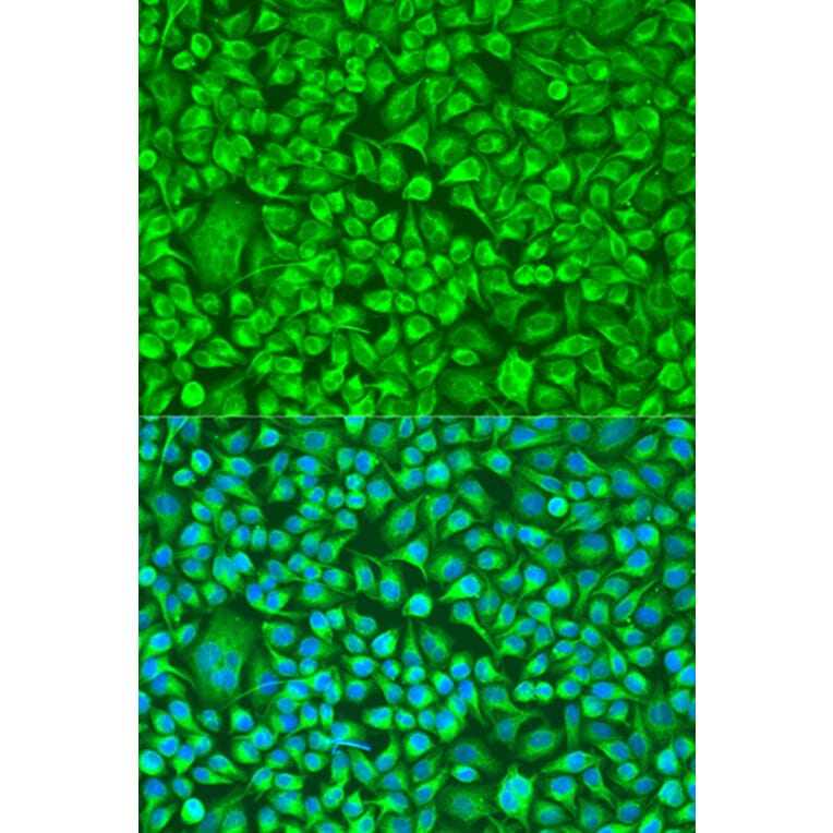 Immunofluorescence - Anti-TUBB8 Antibody (A8396) - Antibodies.com