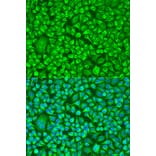 Immunofluorescence - Anti-TUBB8 Antibody (A8396) - Antibodies.com
