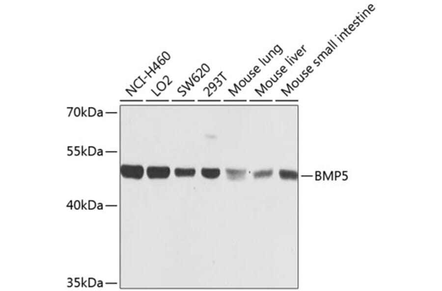 Western Blot - Anti-BMP5 Antibody (A16178) - Antibodies.com