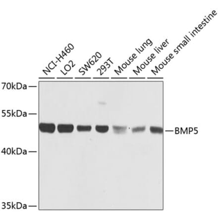 Western Blot - Anti-BMP5 Antibody (A16178) - Antibodies.com