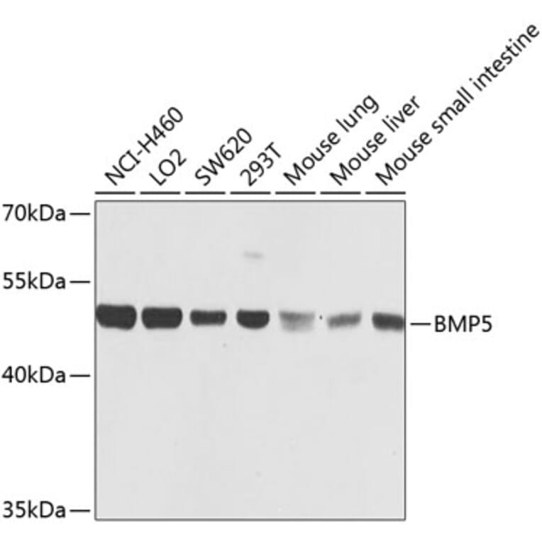 Western Blot - Anti-BMP5 Antibody (A16178) - Antibodies.com