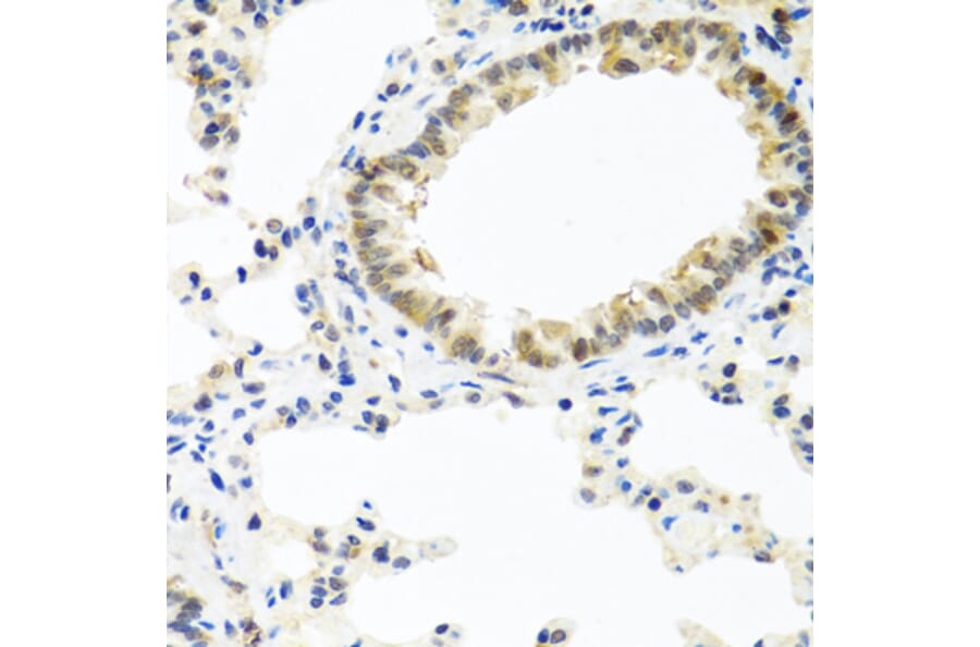Immunohistochemistry - Anti-BMP5 Antibody (A16178) - Antibodies.com