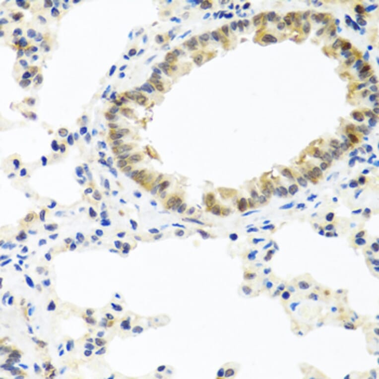 Immunohistochemistry - Anti-BMP5 Antibody (A16178) - Antibodies.com