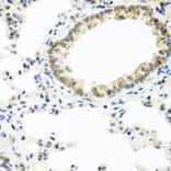 Immunohistochemistry - Anti-BMP5 Antibody (A16178) - Antibodies.com
