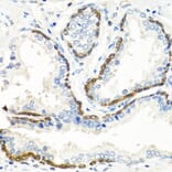 Immunohistochemistry - Anti-BMP5 Antibody (A16178) - Antibodies.com
