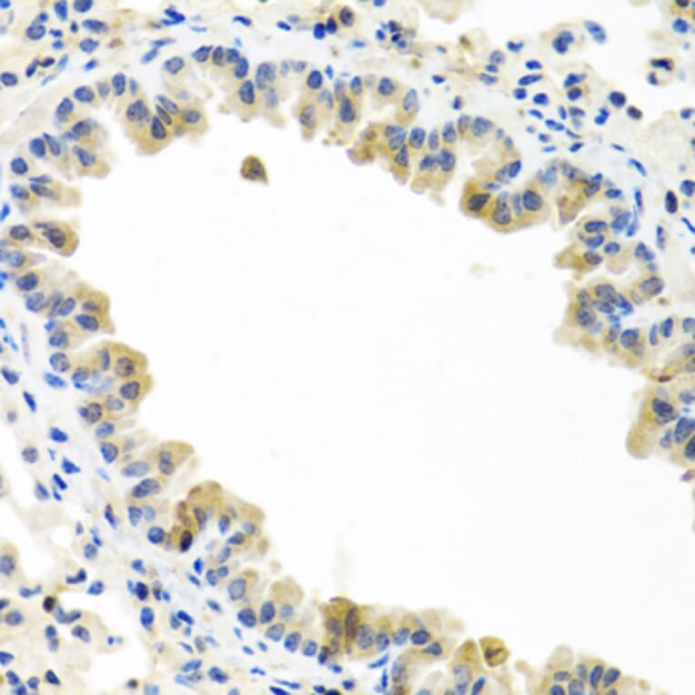 Immunohistochemistry - Anti-BMP5 Antibody (A16178) - Antibodies.com