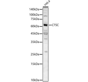 Western Blot - Anti-Cathepsin C Antibody (A16179) - Antibodies.com