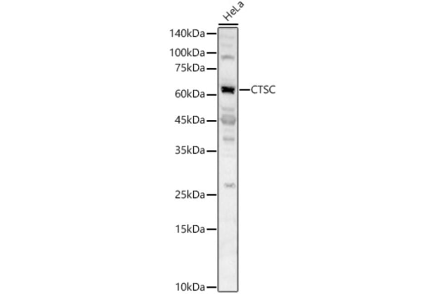 Western Blot - Anti-Cathepsin C Antibody (A16179) - Antibodies.com