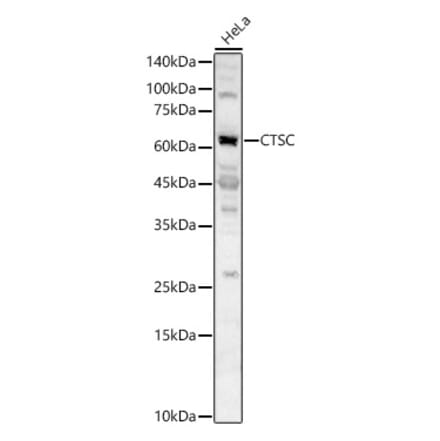 Western Blot - Anti-Cathepsin C Antibody (A16179) - Antibodies.com
