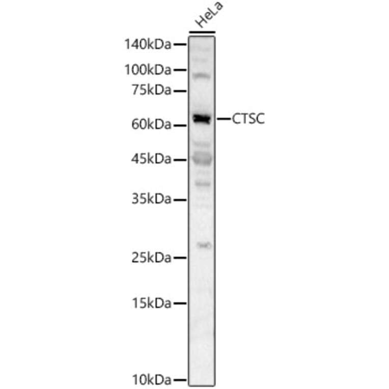 Western Blot - Anti-Cathepsin C Antibody (A16179) - Antibodies.com