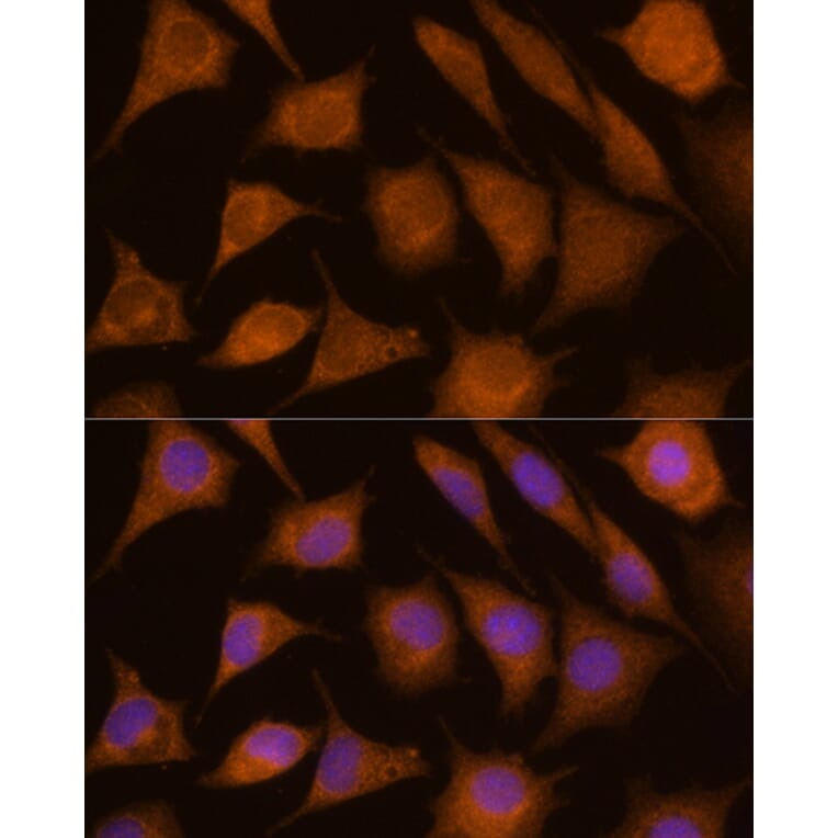 Immunofluorescence - Anti-Cathepsin C Antibody (A16179) - Antibodies.com