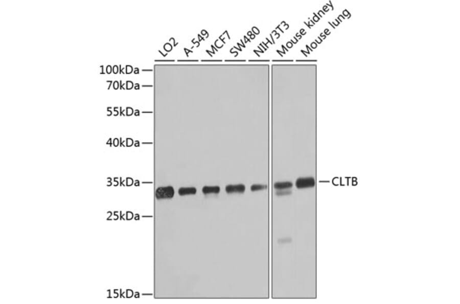 Western Blot - Anti-Clathrin light chain Antibody (A16180) - Antibodies.com