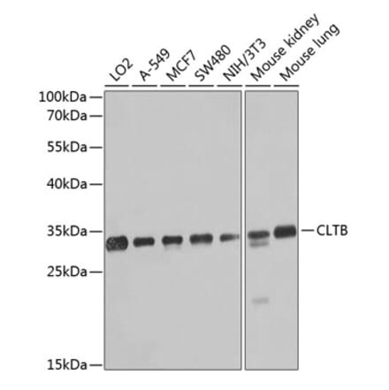 Western Blot - Anti-Clathrin light chain Antibody (A16180) - Antibodies.com