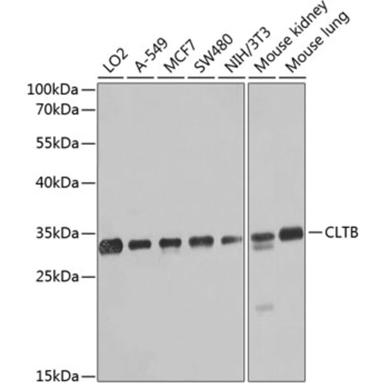 Western Blot - Anti-Clathrin light chain Antibody (A16180) - Antibodies.com