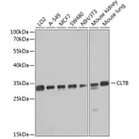 Western Blot - Anti-Clathrin light chain Antibody (A16180) - Antibodies.com