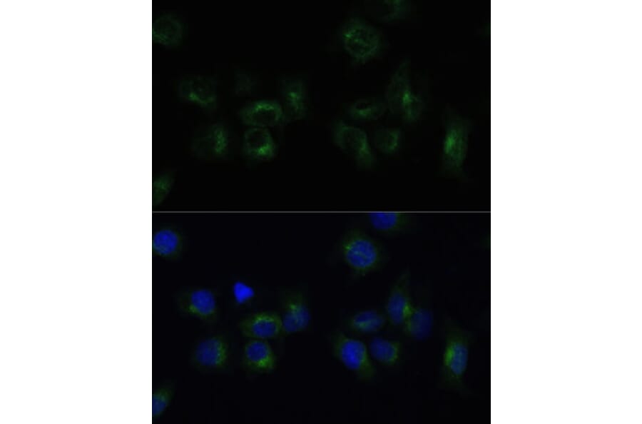 Immunofluorescence - Anti-Clathrin light chain Antibody (A16180) - Antibodies.com