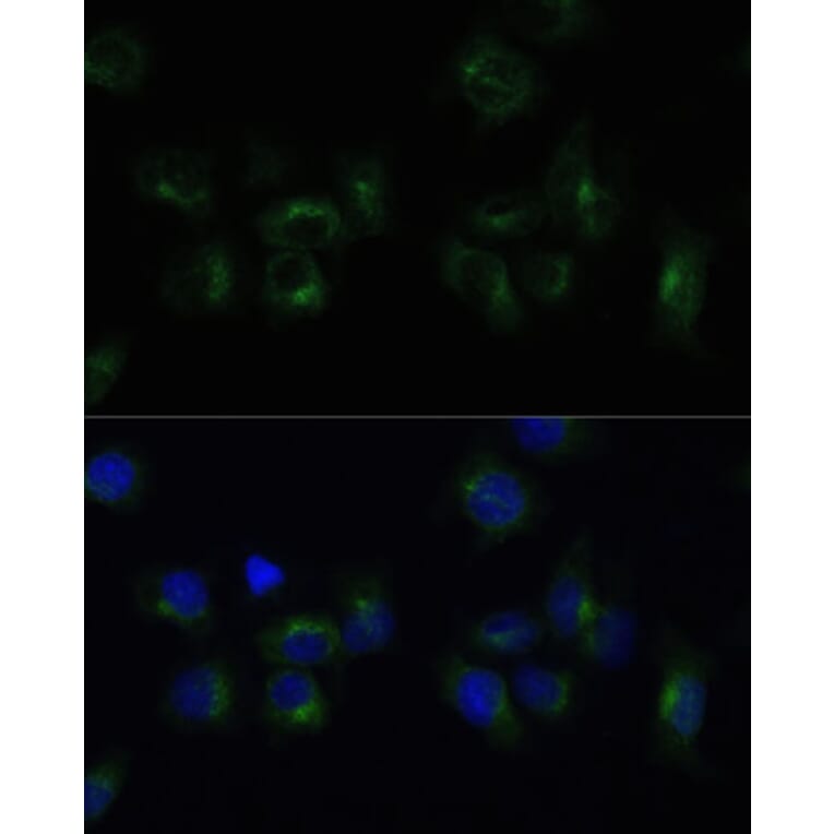 Immunofluorescence - Anti-Clathrin light chain Antibody (A16180) - Antibodies.com