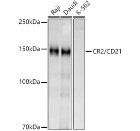 Western Blot - Anti-CD21 Antibody (A16181) - Antibodies.com