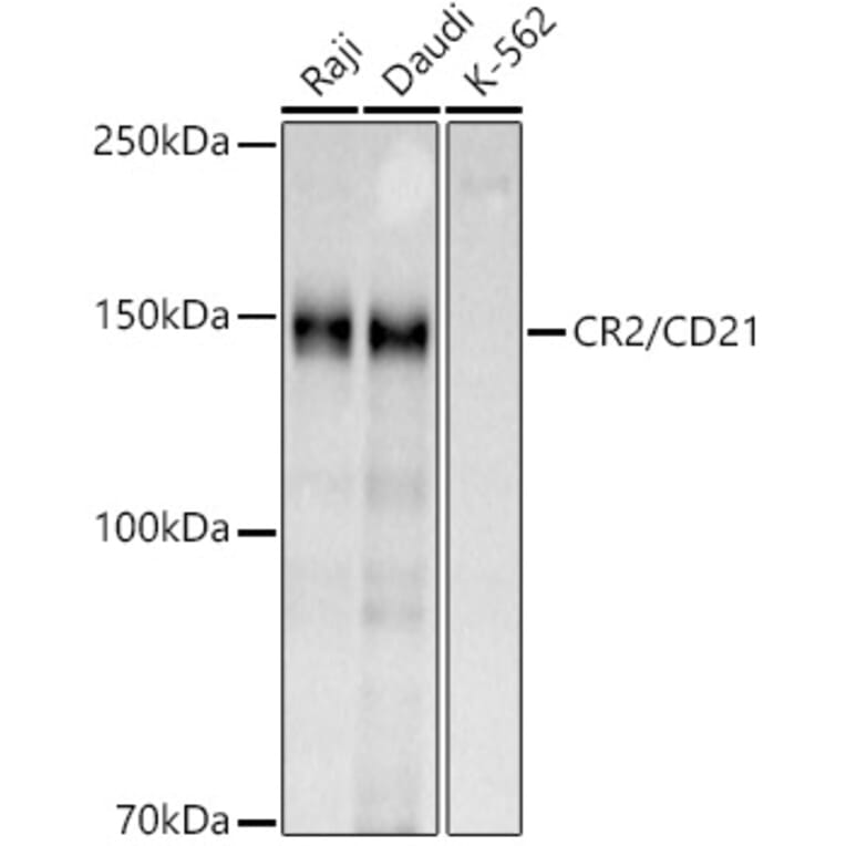 Western Blot - Anti-CD21 Antibody (A16181) - Antibodies.com