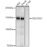 Western Blot - Anti-CD21 Antibody (A16181) - Antibodies.com