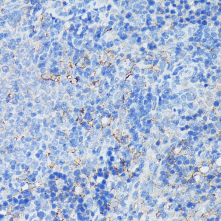Immunohistochemistry - Anti-CD21 Antibody (A16181) - Antibodies.com