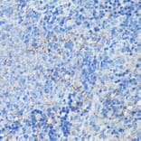 Immunohistochemistry - Anti-CD21 Antibody (A16181) - Antibodies.com