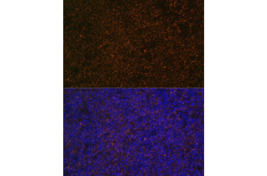 Immunofluorescence - Anti-CD21 Antibody (A16181) - Antibodies.com