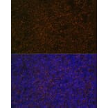 Immunofluorescence - Anti-CD21 Antibody (A16181) - Antibodies.com