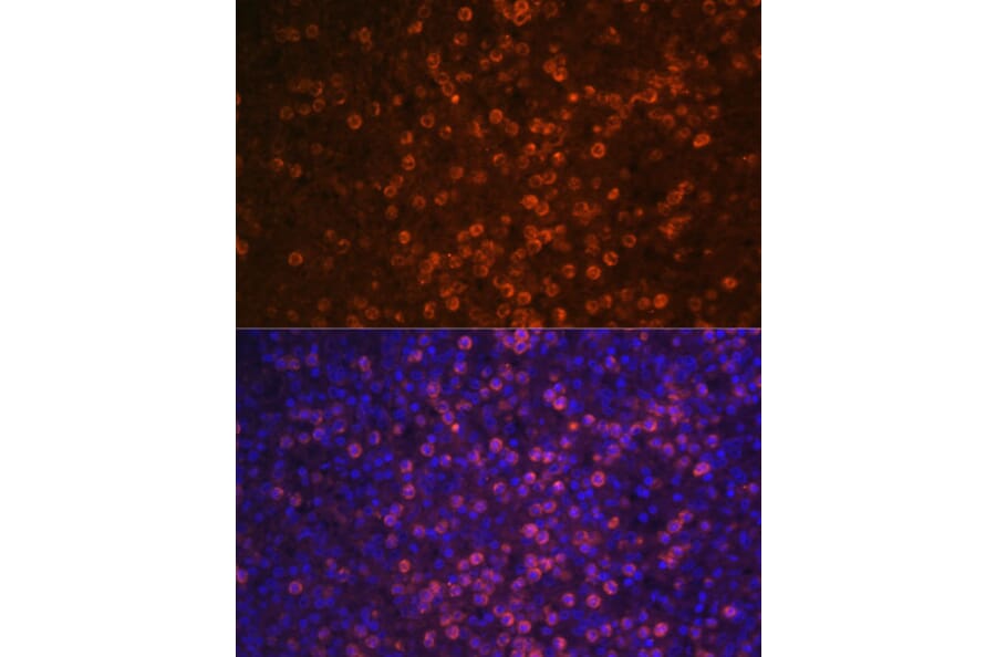 Immunofluorescence - Anti-CD21 Antibody (A16181) - Antibodies.com