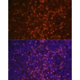 Immunofluorescence - Anti-CD21 Antibody (A16181) - Antibodies.com