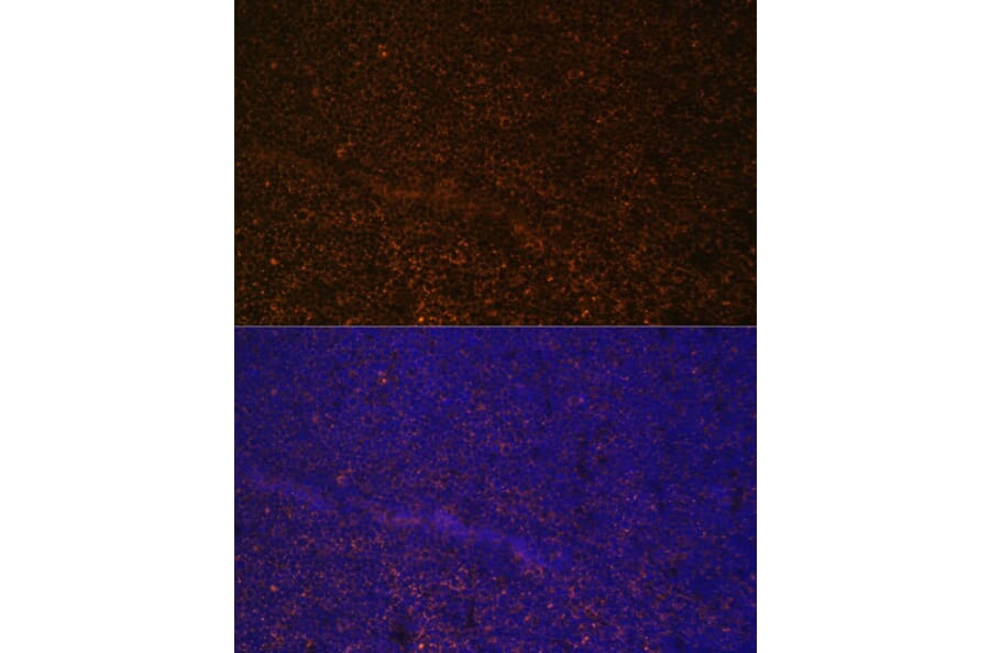 Immunofluorescence - Anti-CD21 Antibody (A16181) - Antibodies.com