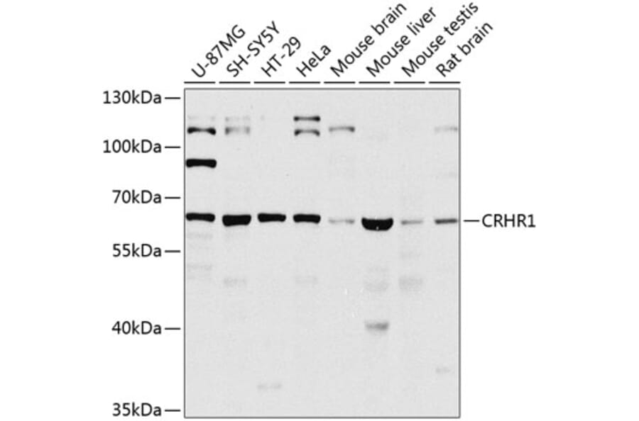 Western Blot - Anti-CRF1/CRHR1 Antibody (A16182) - Antibodies.com