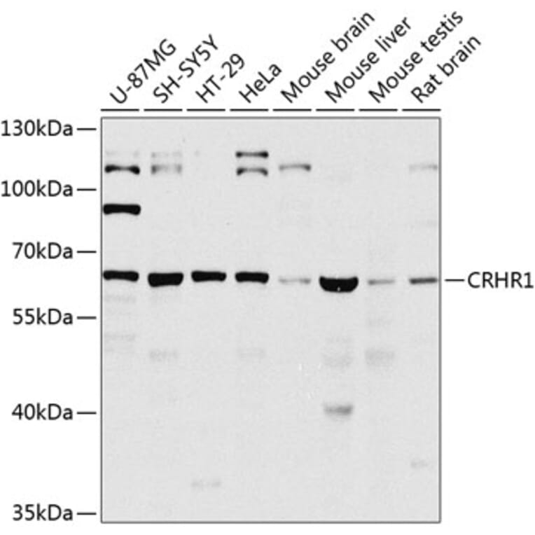 Western Blot - Anti-CRF1/CRHR1 Antibody (A16182) - Antibodies.com
