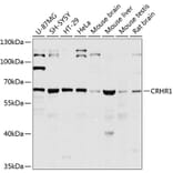 Western Blot - Anti-CRF1/CRHR1 Antibody (A16182) - Antibodies.com