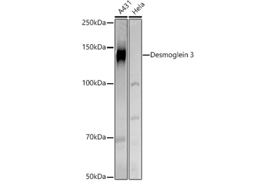 Western Blot - Anti-Desmoglein 3/PVA Antibody (A16183) - Antibodies.com