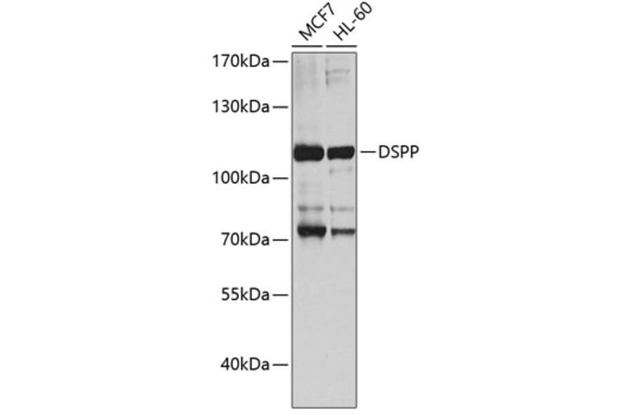 Western Blot - Anti-DSPP Antibody (A8413) - Antibodies.com