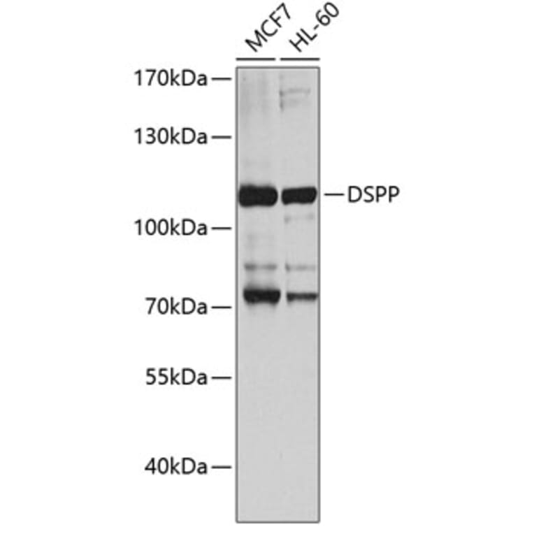 Western Blot - Anti-DSPP Antibody (A8413) - Antibodies.com