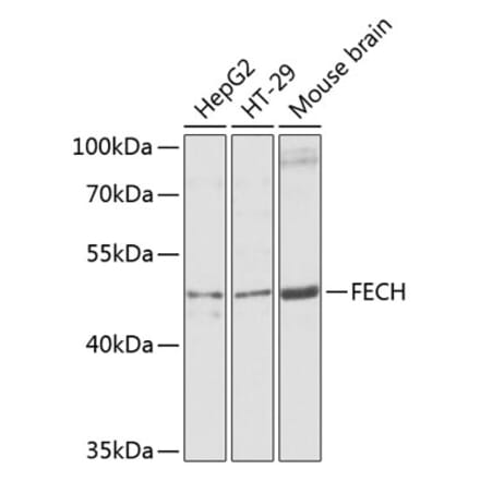 Western Blot - Anti-FECH Antibody (A16185) - Antibodies.com