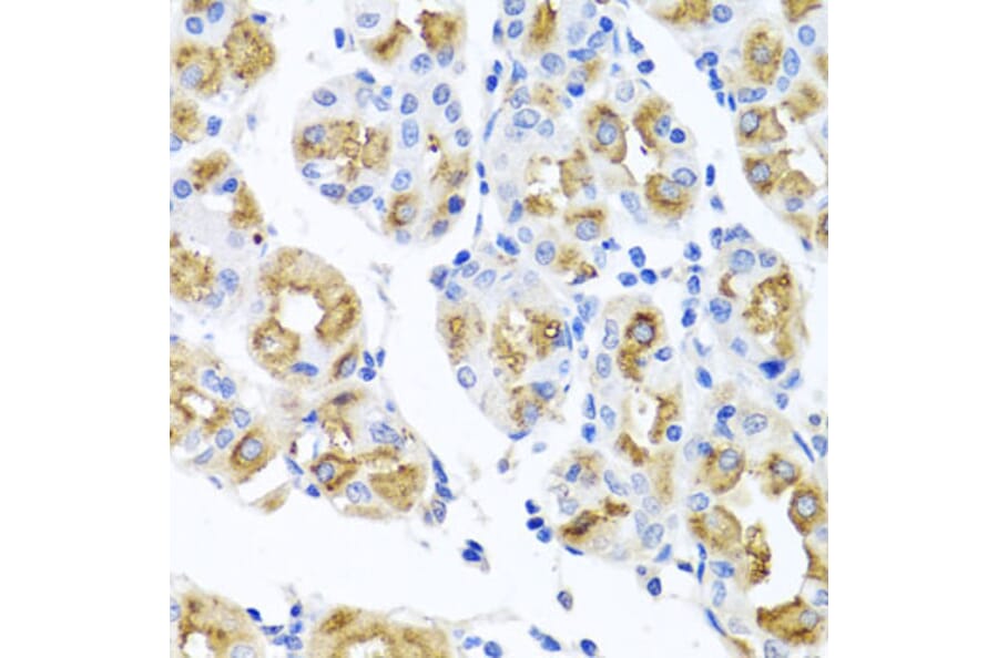 Immunohistochemistry - Anti-FECH Antibody (A16185) - Antibodies.com