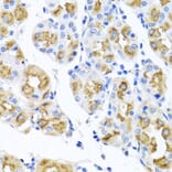 Immunohistochemistry - Anti-FECH Antibody (A16185) - Antibodies.com