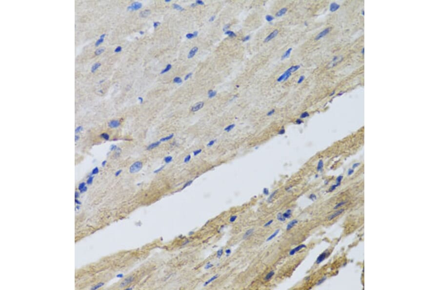 Immunohistochemistry - Anti-FECH Antibody (A16185) - Antibodies.com