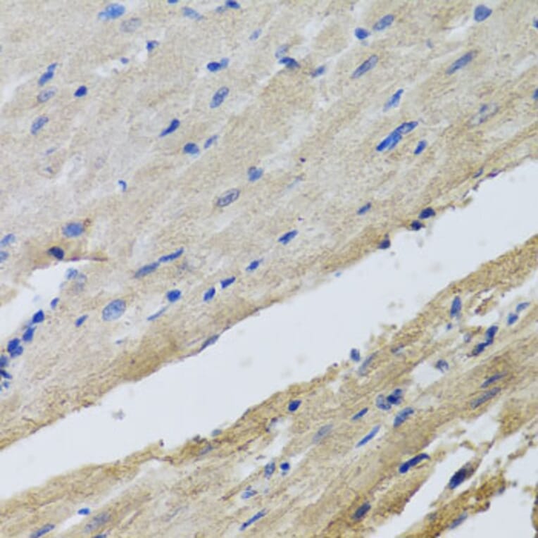 Immunohistochemistry - Anti-FECH Antibody (A16185) - Antibodies.com