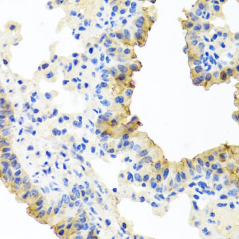 Immunohistochemistry - Anti-FECH Antibody (A16185) - Antibodies.com