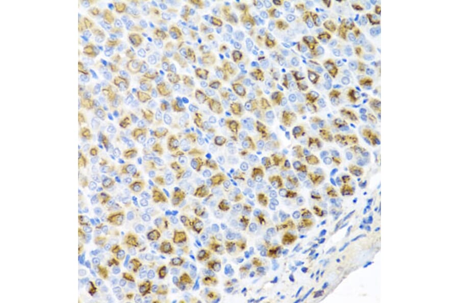 Immunohistochemistry - Anti-FECH Antibody (A16185) - Antibodies.com